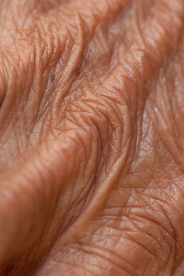 close up view of the skin on an older person's hand