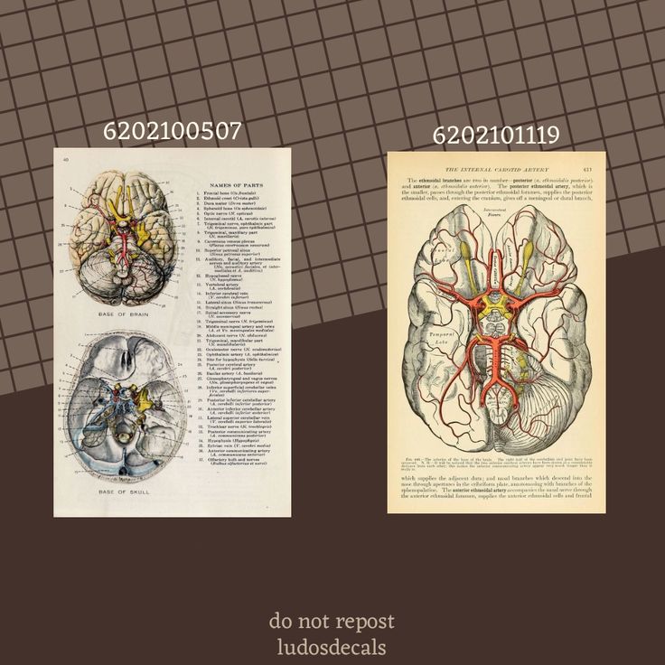 two different views of the human brain