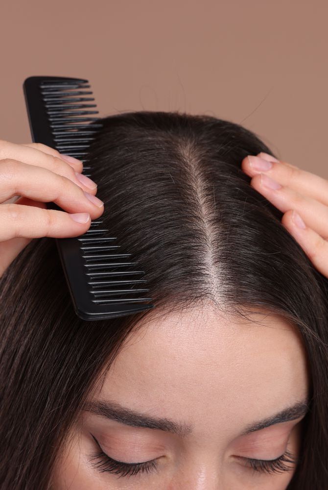 We asked experts how to have a healthy scalp, including clarifying shampoos, how often to wash your hair, and ingredients to look for. #beautyhacks #beautytips #details #scalp #healthyhair Thick Scalp Hair, Healthy Scalp Aesthetic, Healthy Strong Hair, Scalp Health Tips, Smelly Scalp, Scalp Spa, Dry Scalp Remedy, Version Board, Scalp Issues