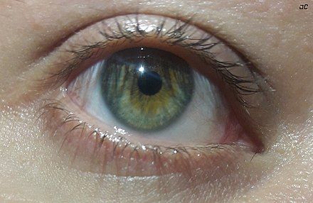 From Wikiwand: Eye with central heterochromia (green and brown) Heterochromia Iridum, Central Heterochromia, Hazel Green Eyes, Rare Eyes, Hazel Green, Pretty Eyes, Green Brown, Green Eyes, Eye Color