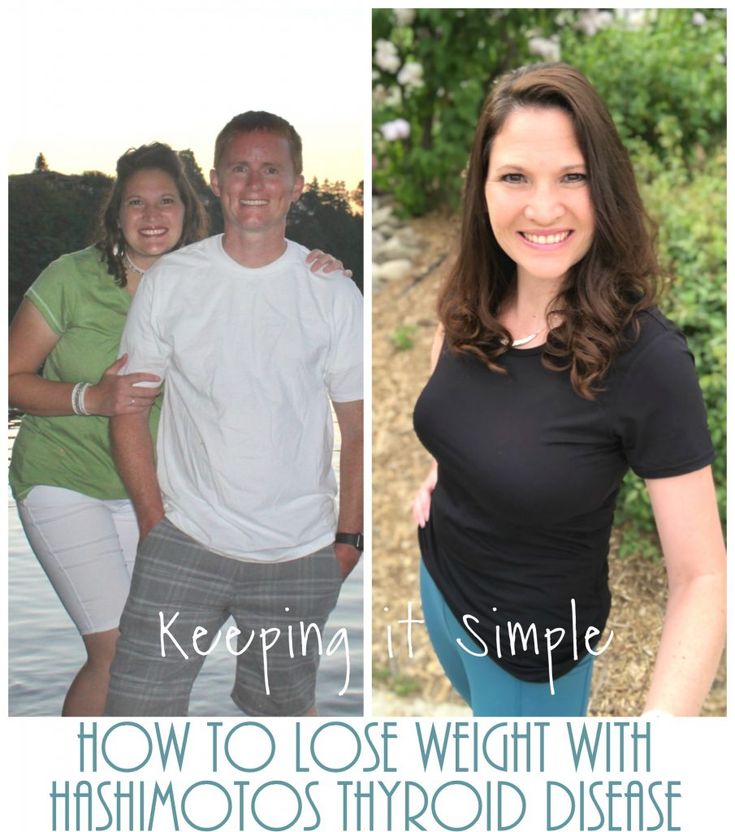 How to Lose Weight with Hashimotos Thyroid Disease- My Journey to a Healthy Lifestyle • Keeping it Simple Hashimotos Disease Diet, Hashimotos Disease, Keeping It Simple, Thyroid Health, A Healthy Lifestyle, Weight Watchers, Disease, Healthy Lifestyle, Diet