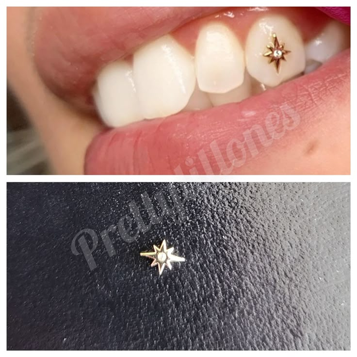 Tooth Jewelry  size are estimate 3mm to 4mm real gold  18kt gold  will not tarnish Gold Tooth Gems Ideas, Tooth Jewelry Diamonds Teeth, Small Tooth Gem, Cute Tooth Gems, Tooth Gems Design, Gold Tooth Gem, Teeth Jewelry Tooth Gems, Tooth Bling, Tooth Gems Aesthetic