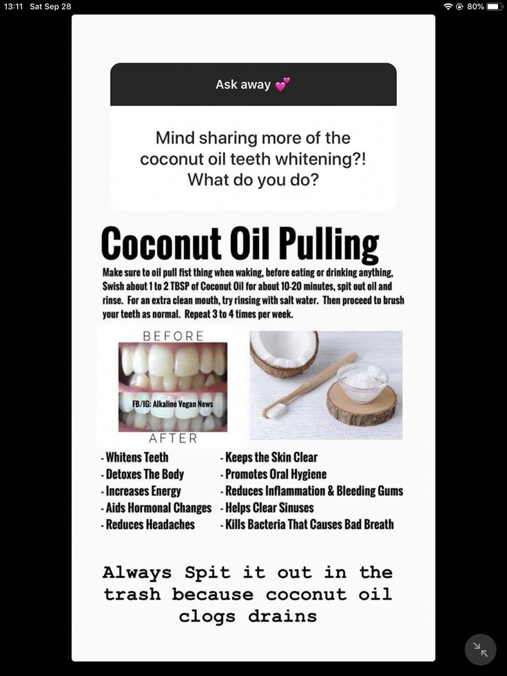 Easy Ways To Whiten Your Teeth, Coconut Oil For Teeth Whitening, Coconut Oil Teeth, Oil Pulling With Coconut Oil, Oil Swishing, Coconut Teeth Whitening, Skincare 2023, Coconut Oil Teeth Whitening, Tooth Extraction Healing