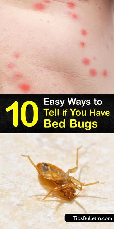 the top ten bed bugs that are on someone's chest, and below it is an image of them with red spots