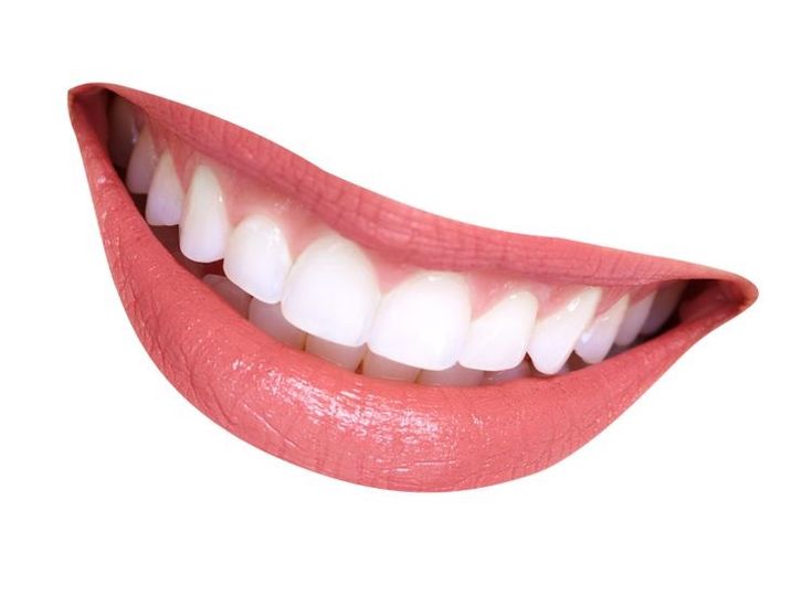 a woman's mouth with white teeth