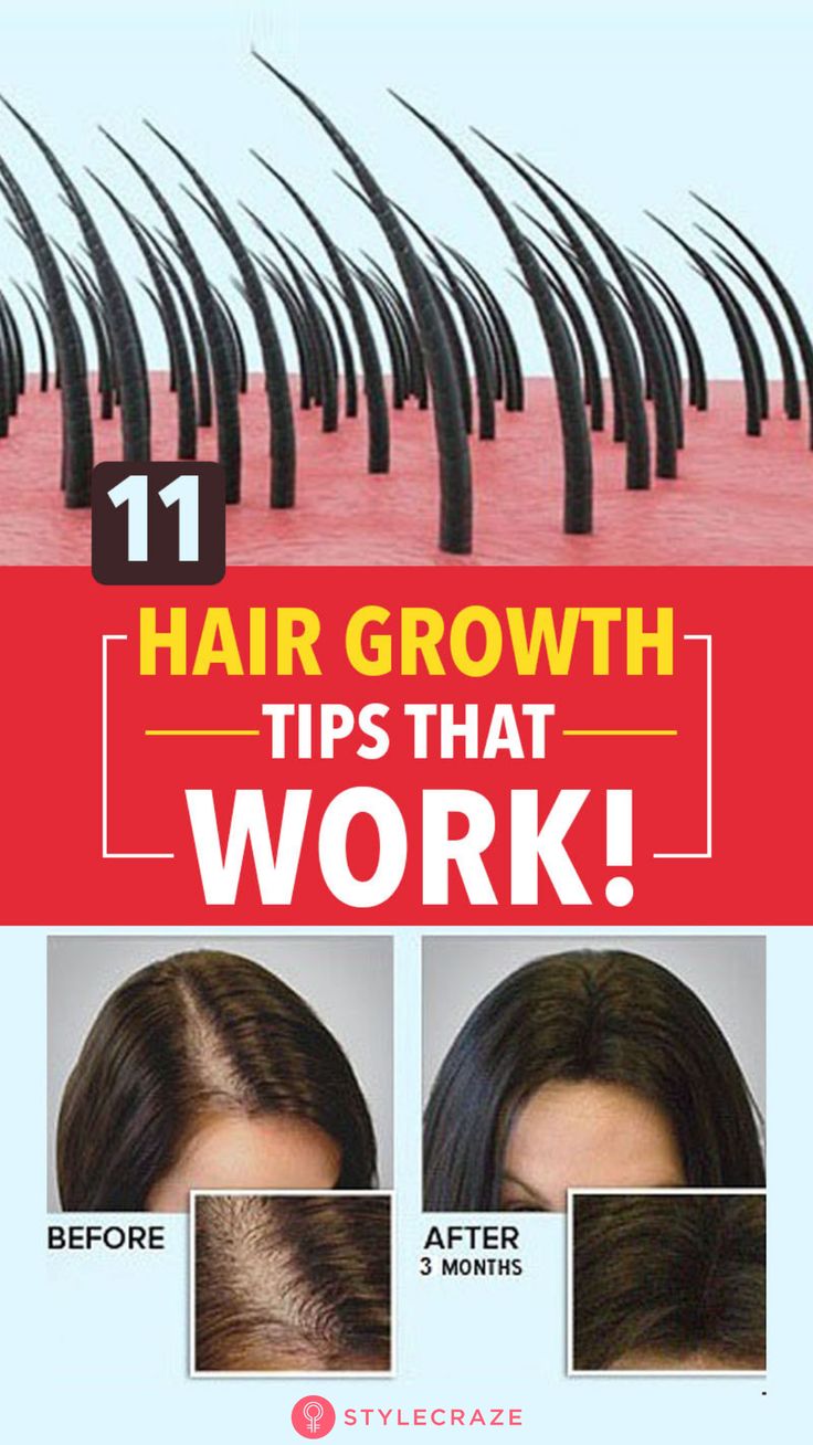 Before your dull and thinning hair could get any worse, it’s time to take action.All it takes is regular care and some handy tips that will set it right. Check out the tips mentioned below to make your hair long and thick. #Hair #HairCare #ThickHair Indian Hair Growth Secrets, Thicker Hair Naturally, Grow Thicker Hair, Get Thicker Hair, Healthy Natural Hair Growth, Easy Care Hairstyles, Make Hair Grow, Natural Hair Growth Tips, Hair Growth Secrets