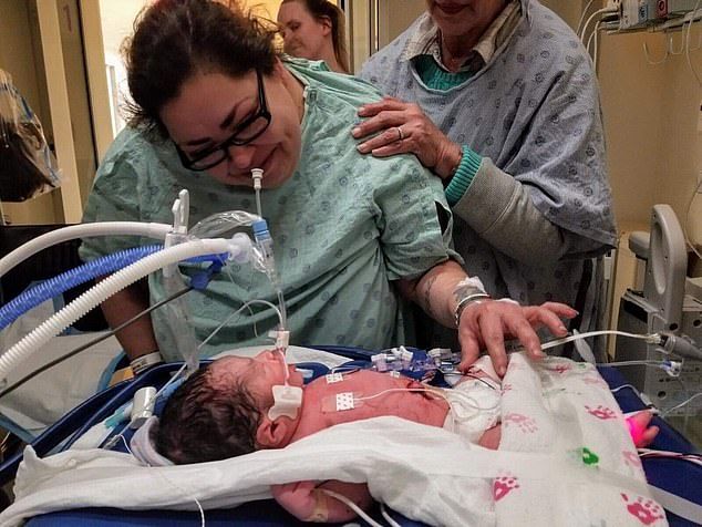 a woman in a hospital bed with an oxygen tube hooked up to her baby's head