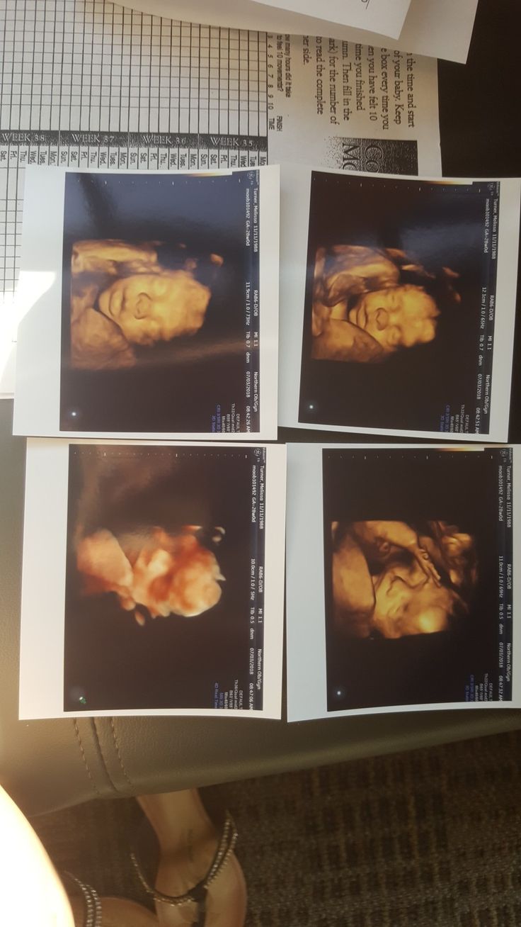 four photographs of a woman's face are shown on top of a table with papers