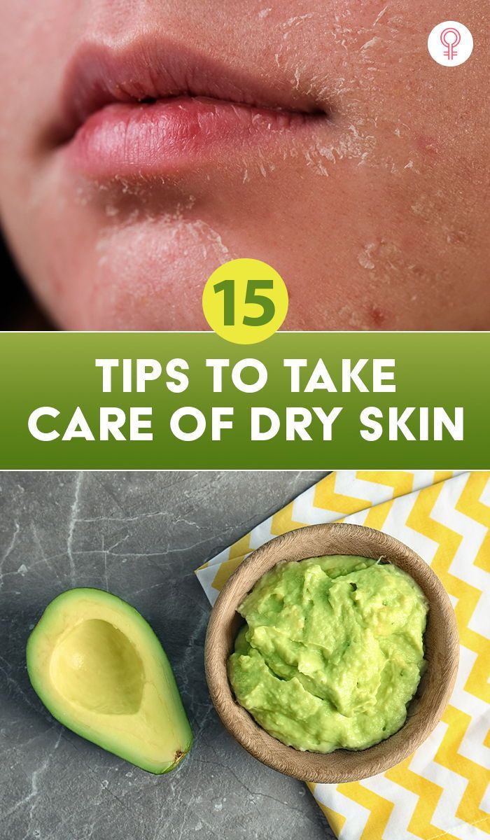 Flaky Skin On Face, Dry Patchy Skin, Dry Skin Home Remedies, Tips For Dry Skin, Dry Peeling Skin, Dry Skin Diy, Super Dry Skin, Facial For Dry Skin, Dry Skin Care Routine