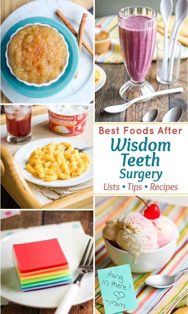 Wisdom Teeth Diet, Soft Foods After Tooth Extraction, Wisdom Tooth Care Package, Soft Meals After Surgery Teeth, Wisdom Teeth Recovery Food, Soft Foods After Surgery Teeth, Wisdom Illustration, Wisdom Teeth Removal Food, Wisdom Teeth Care Package