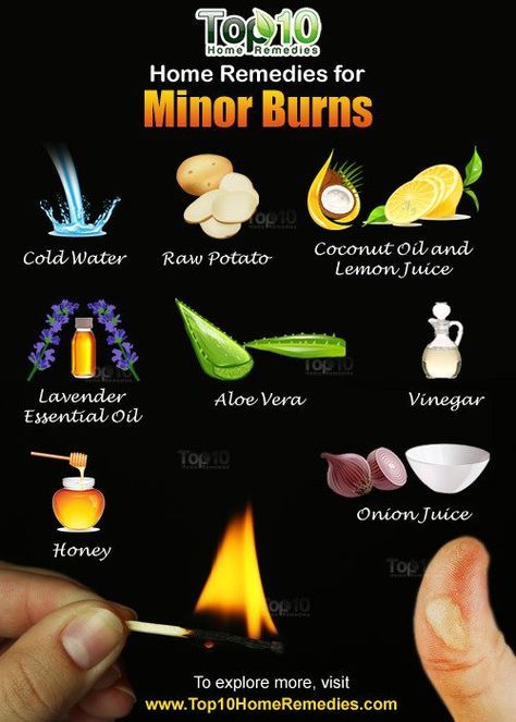 Home Remedies For Burns, Layers Of The Skin, Burn Remedy, Burn Relief, Treat Burns, Top 10 Home Remedies, Holistic Remedies, Wound Care, Skin Remedies