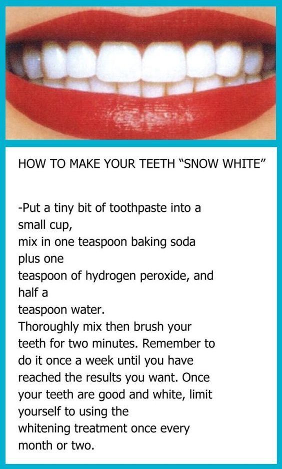 Obličejové Masky, Teeth Whitening Diy, Natural Teeth Whitening, Natural Teeth, Beauty Remedies, Teeth Care, White Teeth, Health And Beauty Tips, Beauty Treatments