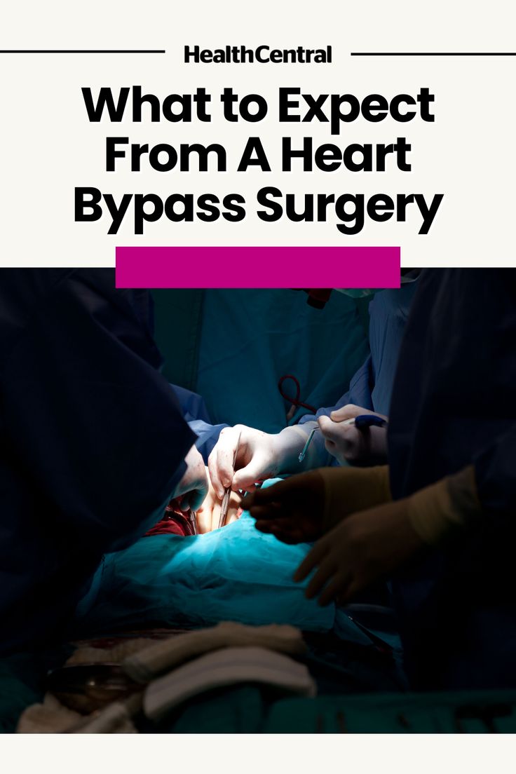 Despite a heart bypass surgery being a significant (and scary-sounding) medical intervention, this common heart surgery boasts an exceptionally high success rate and can significantly decrease your likelihood of having a heart attack. Here's what to expect before, during, and after the operation to help you be more prepared for the process and what types of outcomes you can expect. Bypass Surgery Heart, Cardiac Rehabilitation, Bypass Surgery, Coronary Arteries, Heart Surgery, Cleveland Clinic, Chest Pain, Post Surgery, Success Rate