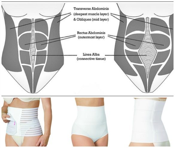 three images showing the different types of tummy wraps and their corresponding features are shown