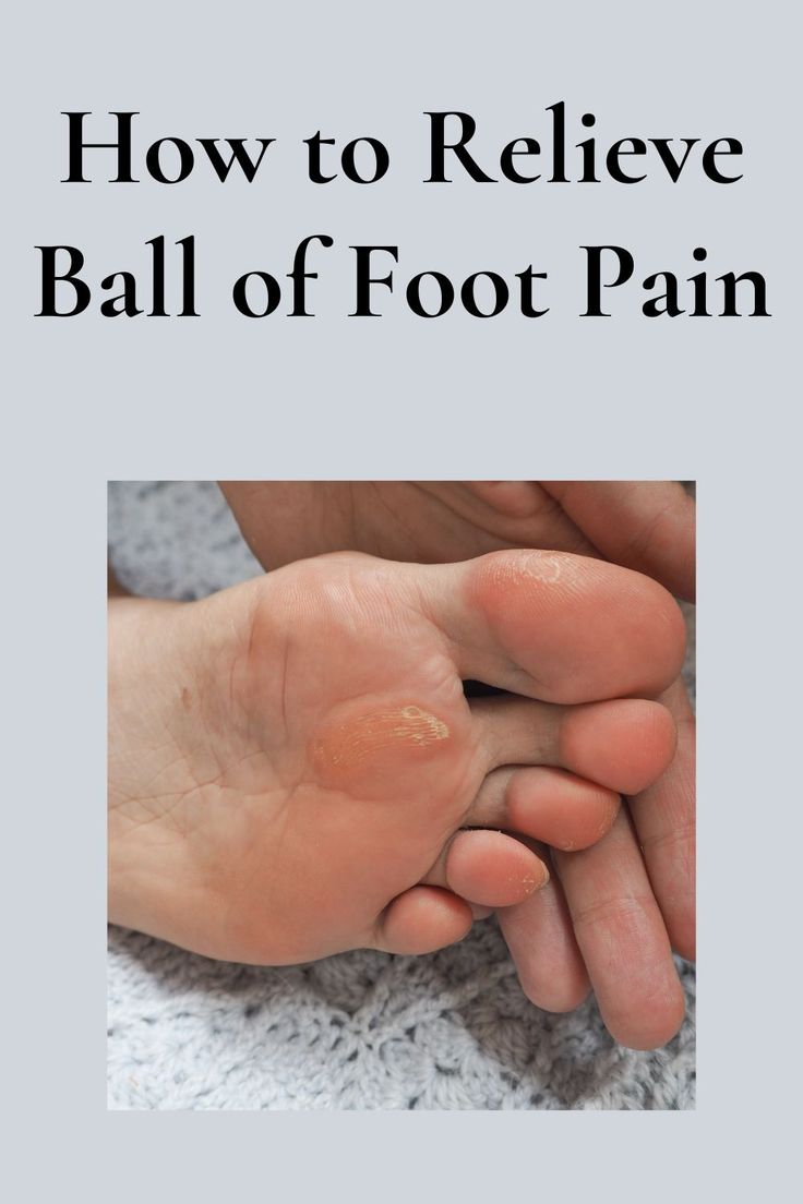 Ball of foot pain can be a frustrating and debilitating issue that affects many people. It can cause discomfort and pain when walking, running, or standing for long periods of time. Fortunately, there are several ways to relieve ball of foot pain and get back to your daily activities. Sore Feet Relief, Foot Pain Chart, Sore Feet Remedies, Foot Pain Relief Remedies, Nerve Pain Remedies, Ankle Exercises, Pain Relief Remedies, Foot Exercises, Healing Remedies