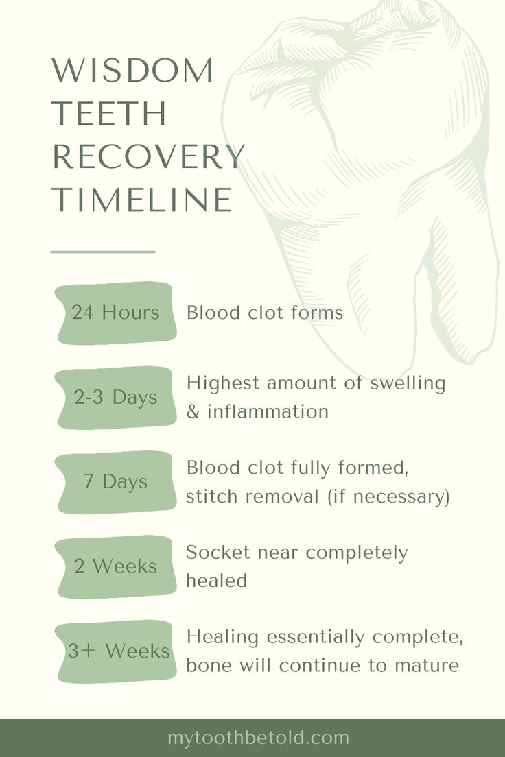 Hygienists Guide: Eating Popcorn After Wisdom Teeth Removal Avoid popcorn for 7-14 days post wisdom tooth removal to allow proper healing and minimize the risk of complications like dry socket and infection. Popcorn can disrupt healing by lodging in extraction sites. Individual medical history, age, and health conditions can affect healing times. Prioritizing healing in the first week will set you up for success and allow you to heal much faster. Wisdom Teeth Recovery Food, Eating After Tooth Extraction, Wisdom Teeth Food, Wisdom Teeth Recovery, Wisdom Tooth Removal, After Wisdom Teeth Removal, Teeth Surgery, Baby Tooth Decay, Eating Popcorn