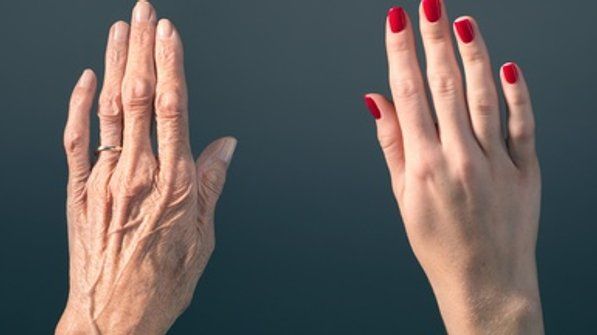 Aging Is Reversible—at Least in Human Cells and Live MiceChanges to gene activity that occur with age can be turned back, a new study shows Reverse Aging, Crepey Skin, Anti Aging Tips, Sagging Skin, Aging Well, Aging Process, Look Younger, Aging Signs, Wrinkles