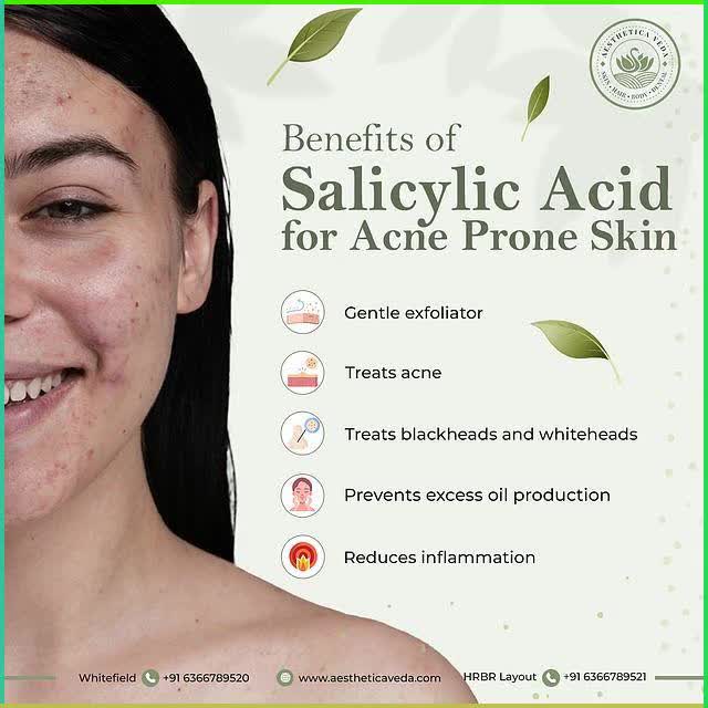 Well, now that we are aware of the benefits of Salicylic acid, you can as well look forward to having acne-free skin. To know more visit: https://aestheticaveda.com/ Call us at : 📞Whitefield :  91 6366789520 📞 HRBR Layout :  91 6366789521 #Aesteticaveda #benefitsofsalicylicacid #salicylicacid #acne #acnescars #acnetreatment #acid #healthyskin #healthyskincare #healthyskintips #clearskin #clearskintips See less