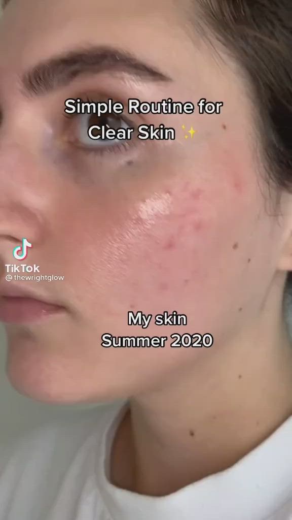 This contains: How to get clear skin fast!