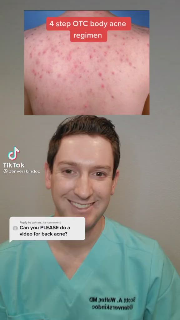 This contains: Short skin care vid on back and body acne.