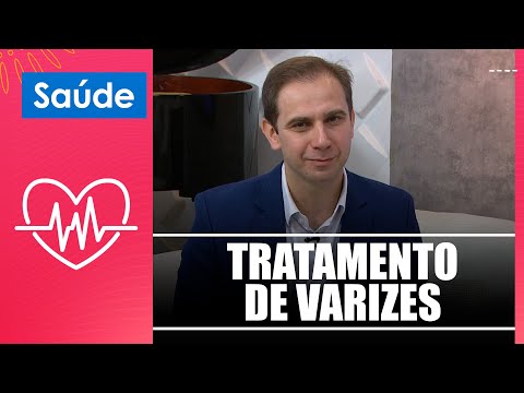 Saiba mais sobre o tratamento de varizes com o Dr. Fernando Bacalhau – 15/11/24