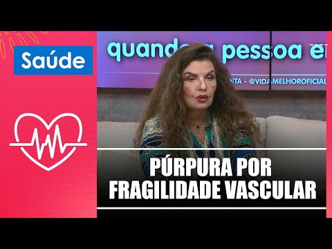 Saiba tudo sobre púrpura por fragilidade vascular com a Dra. Ligia Kogos – 22/11/24