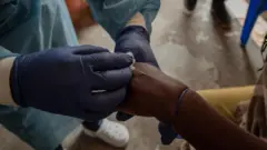 Um profissional de saúde coleta uma amostra no centro de tratamento de mpox do hospital geral de referência de Nyiragongo, ao norte da cidade de Goma, na República Democrática do Congo, em 16 de agosto de 2024