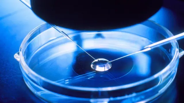 Imagem de fertilização in vitro