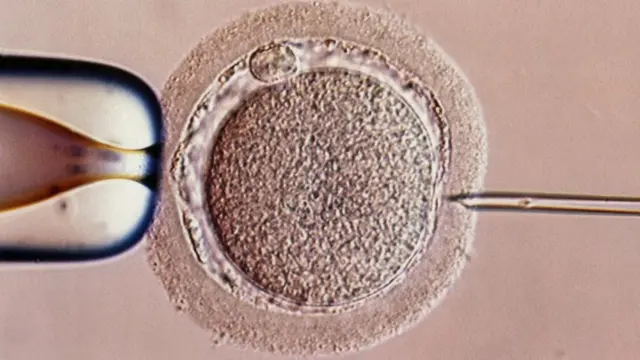 Imagem de fertilização in vitro