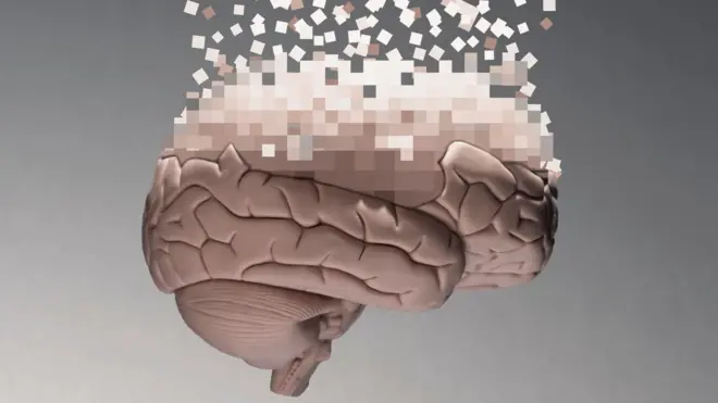 Ilustração de cérebro humano