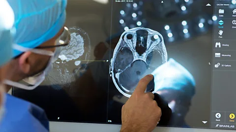 Alamy Stimulating the brain during "awake surgery" has allowed surgeons to determine the function of different networks of neurons (Credit: Alamy)