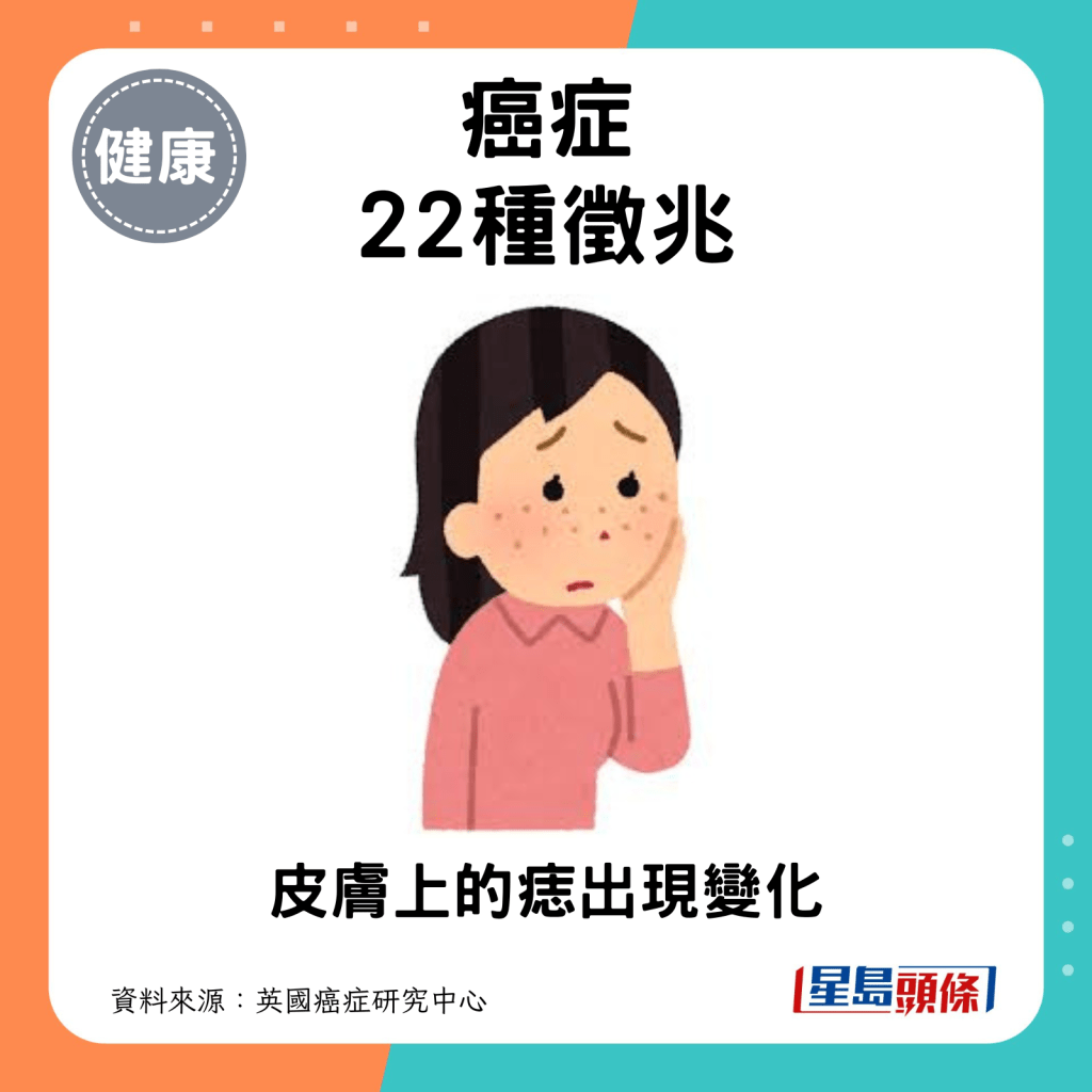 癌症22種徵兆：新痣或痣出現變化。