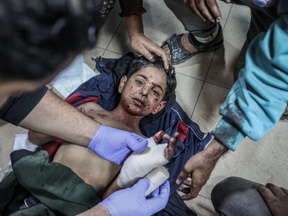 Un niño herido a causa de un ataque al campo de refugiados de Al Maghazi  recibe atención médica en el hospital Aksa, en Deir al Balah, este lunes.