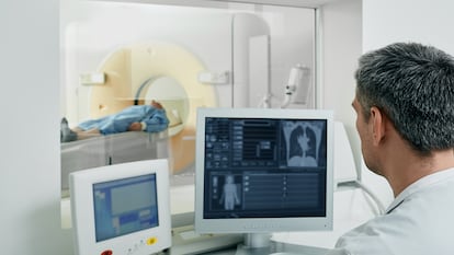 La tomografía computarizada de baja dosis de radiación, lo que normalmente se conoce como TAC, es la prueba recomendada para el cribado de cáncer de pulmón.