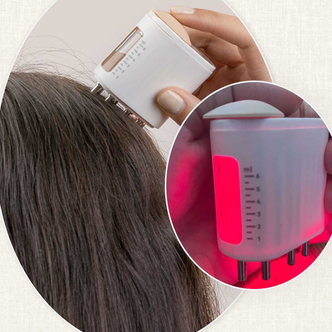 I’m 42 with thinning hair and credit Amazon’s LED Head Massager for slowing down hair loss