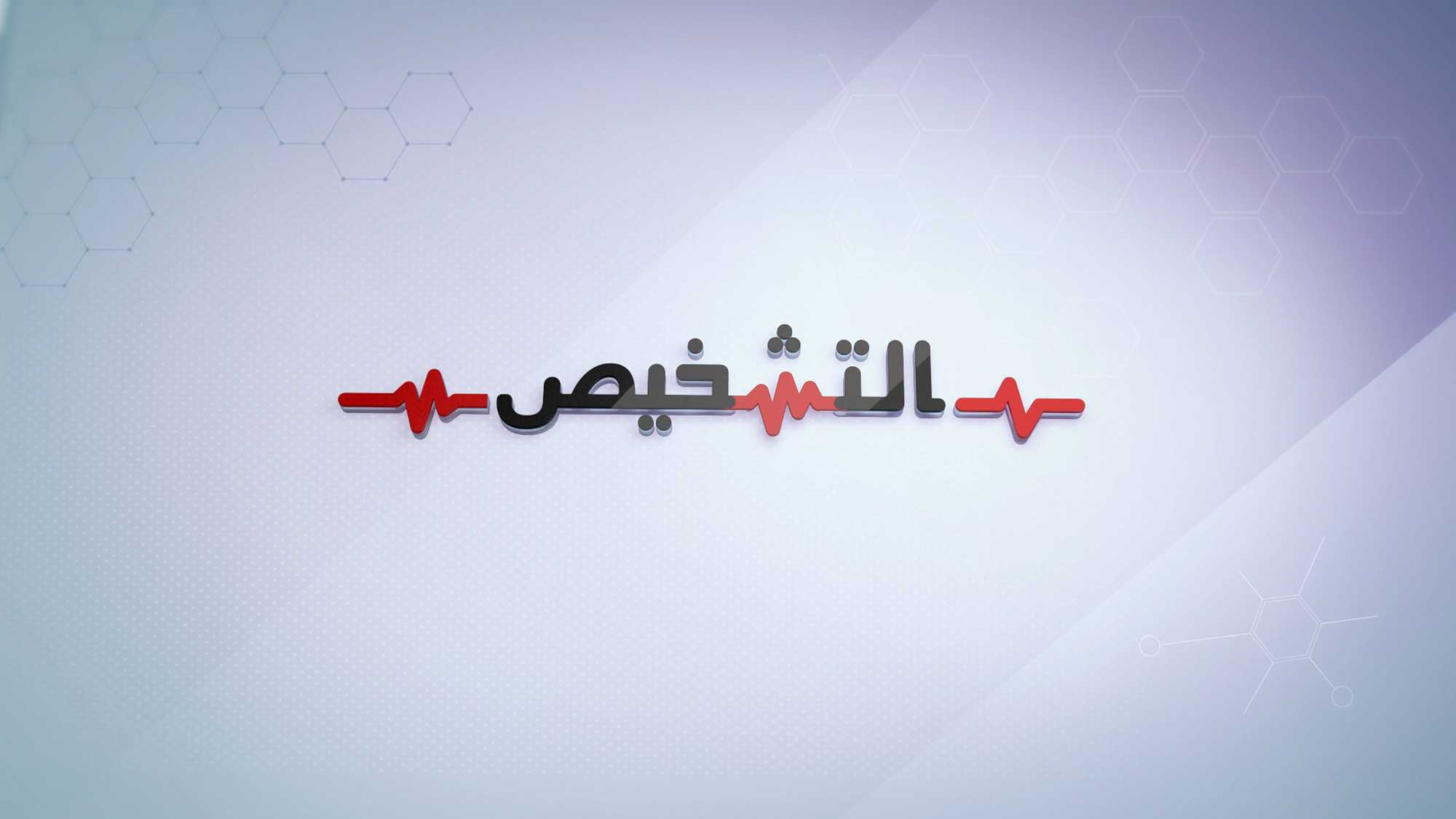 التشخيص