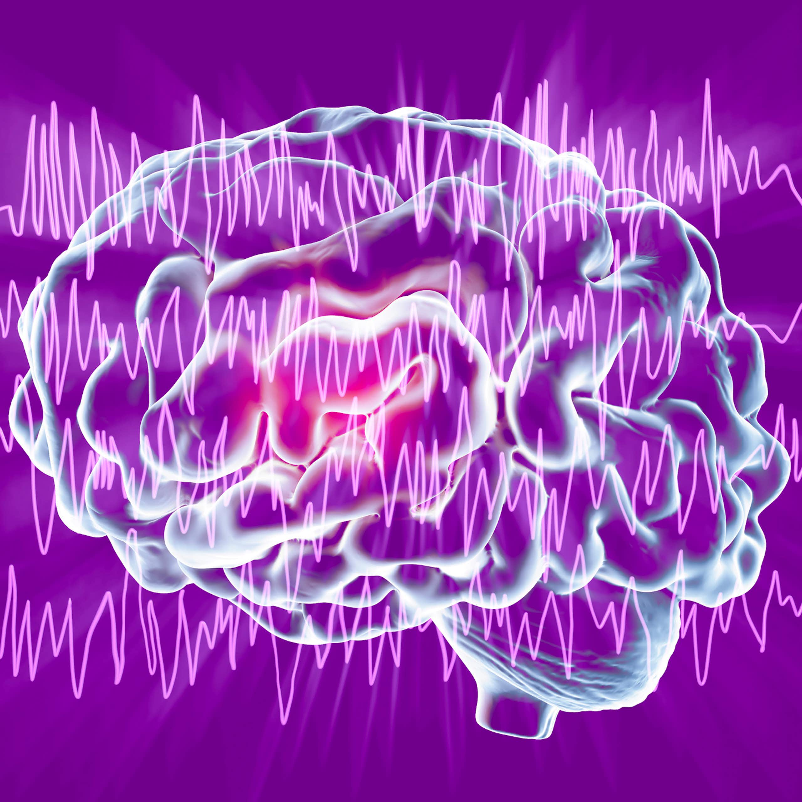 Illustration of brain with EEG epilepsy reading superimposed across it