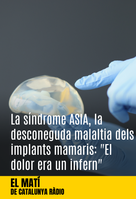 Imatge de:La síndrome ASIA, la desconeguda malaltia dels implants mamaris: "El dolor era un infern"