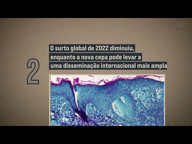 DESTAQUE ONU NEWS