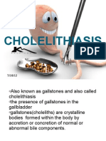 CHOLElithiasis