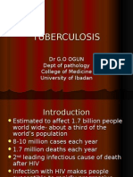 Tuberculosis