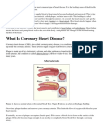 Coronary Artery Disease