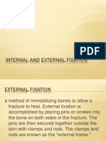 Internal and External Fixation