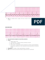 ECG Strips