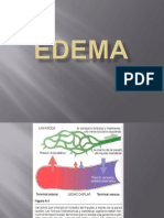 Edema