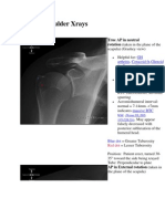 Normal Shoulder Xrays: True AP in Neutral Rotation (Taken in The Plane of The