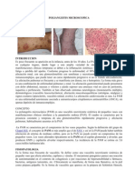 Poliangeitis Microscopica