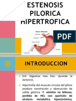 Estenosis Pilorica Hipertrofica