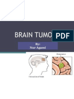 Brain Tumor