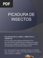 Picadura de Insectos